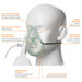 H2001313_sauerstoffmaske_beutel_02